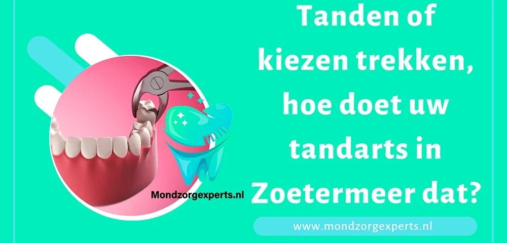 Tanden of kiezen trekken, hoe doet uw tandarts in Zoetermeer dat?