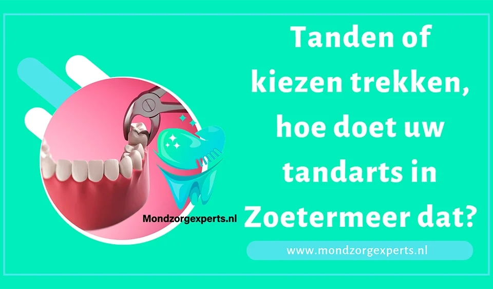 Tanden of kiezen trekken, hoe doet uw tandarts in Zoetermeer dat?