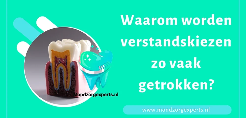 Waarom worden verstandskiezen zo vaak getrokken?
