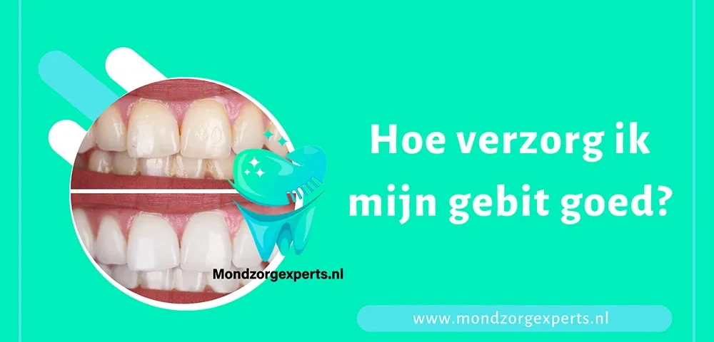 Hoe verzorg ik mijn gebit goed?