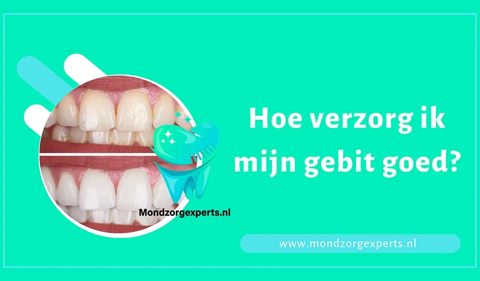 Hoe verzorg ik mijn gebit goed?